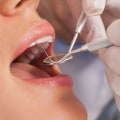 What Materials Can UK Dentists Use for Fillings and Crowns?