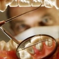 How Often Should You Have Your Teeth Checked by a UK Dentist for Signs of Decay or Gum Disease?
