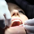 What Treatments Do UK Dentists Offer?