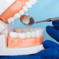 Where Does the UK Rank in Dental Care?