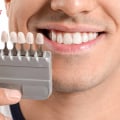 What Are the Regulations for Cosmetic Dentistry in the UK?
