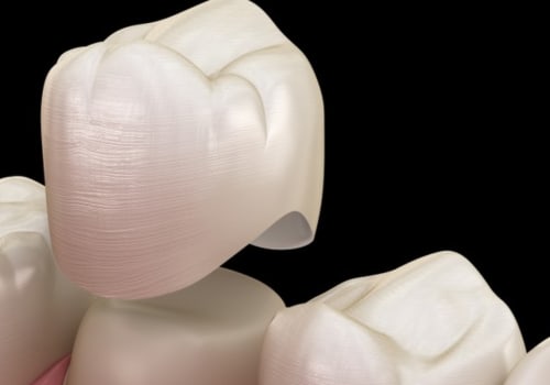 What Materials Can NHS Dentists Use for Fillings and Crowns in the UK?