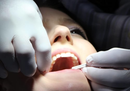 How Much Does it Cost to Get a Filling at a UK Dentist?